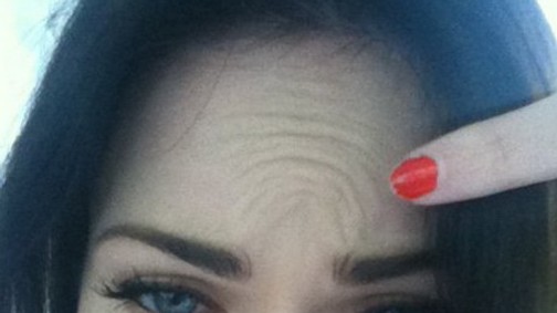 Megan Fox: Nincs botox!