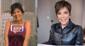 Talán Kris Jenner használta legjobban a szépészeti beavatkozások adta lehetőségeket. 50 éves volt, amikor debütált a KUWTK első része és most 65 évesen is üde és fiatalos. 