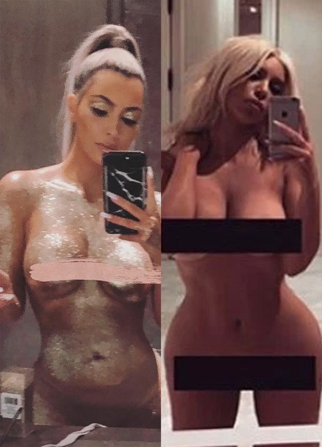 Hová tűnt Kim Kardashian fenékimplantátuma?