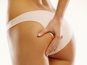 Feszes a tempó? Itt vannak a legjobb bőrfeszesítő termékek a narancsbőr ellen