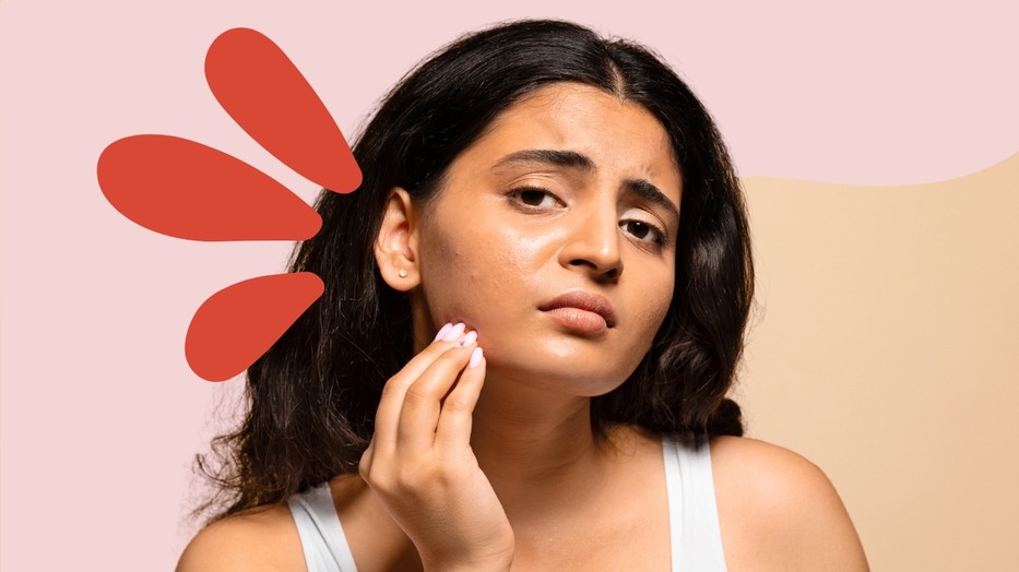 Ez történik a bőröddel, amikor stressz hatása alatt állsz