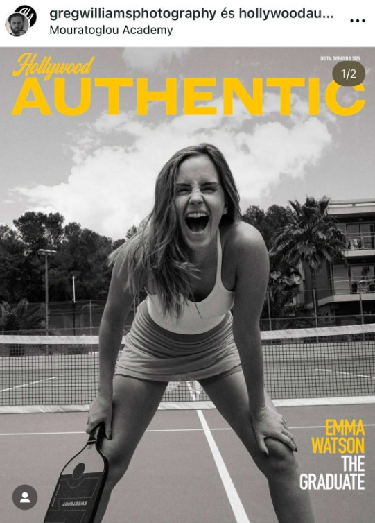 Emma Watson új címlapfotója minden, csak nem kiszámítható