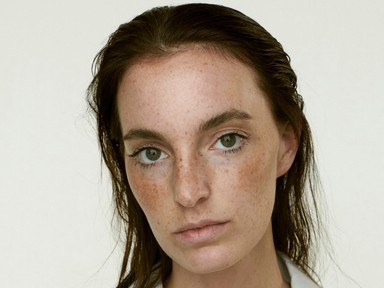 Igen, vállalom: modell vagyok és közben önbizalomhiányos