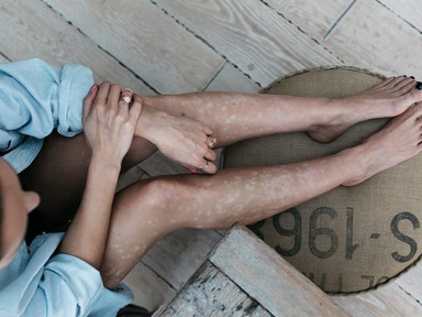 Pikkelysömöröd van? Ha teszel érte, tünetmentesen élhetsz!