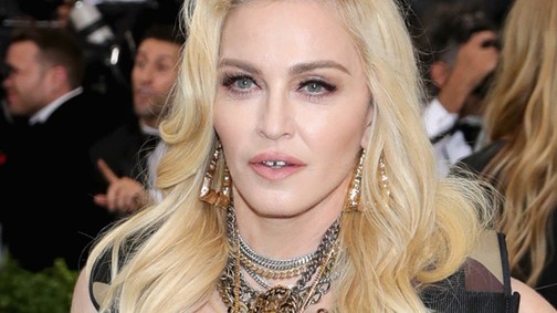 Madonna annyira tróger, hogy az már fáj