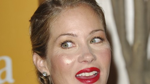 Christina Applegate nagyon rosszul sikerült plasztikai beavatkozása