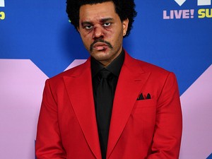 Mi a fene történt The Weeknd arcával?