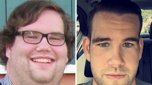 Így változik az ember arca a fogyástól! *Megdöbbentő előtte-utána fotók!*