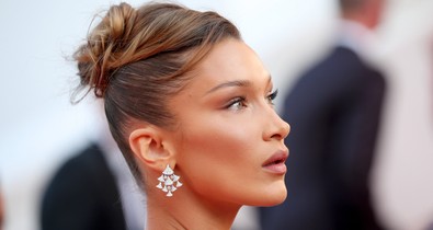 Kifejezetten undorító plasztikai műtét a sztárok hangsúlyos arccsontjának titka