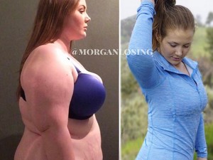 Törölték ennek a lánynak a fotóját - Miért nem tetszik az Instagramnak a fogyás?