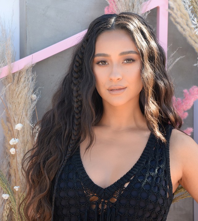 15 sztár, akiknek nagyon problémás a bőre, és mit tesznek ellene