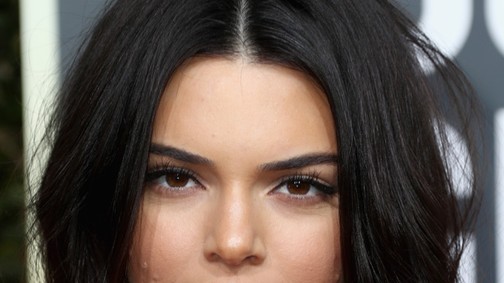 Mindenkit lesokkolt Kendall Jenner pattanásos arcbőre a Golden Globe-on