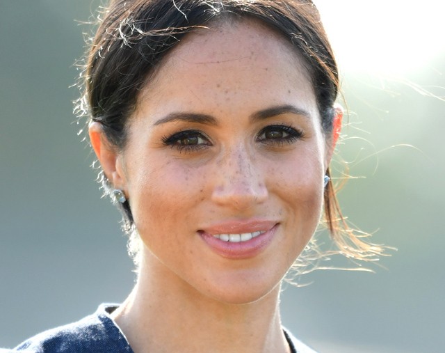 Így varázsolhatsz magadnak pillanatok alatt gyönyörű szeplőket