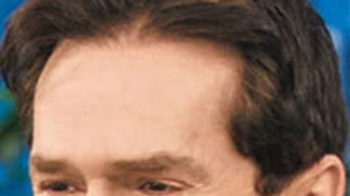 Mi történik, ha egy pasi plasztikáztat?