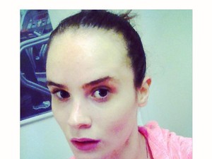 Második lépés kipipálva - Nagy Réka a kórház után visszatér!