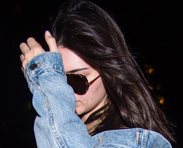 Kendall Jenner arcbőre