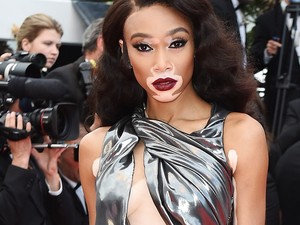 Winnie Harlow olyan erotikus fenékrázást nyomott, hogy csoda, hogy nem tiltotta le az Instagram