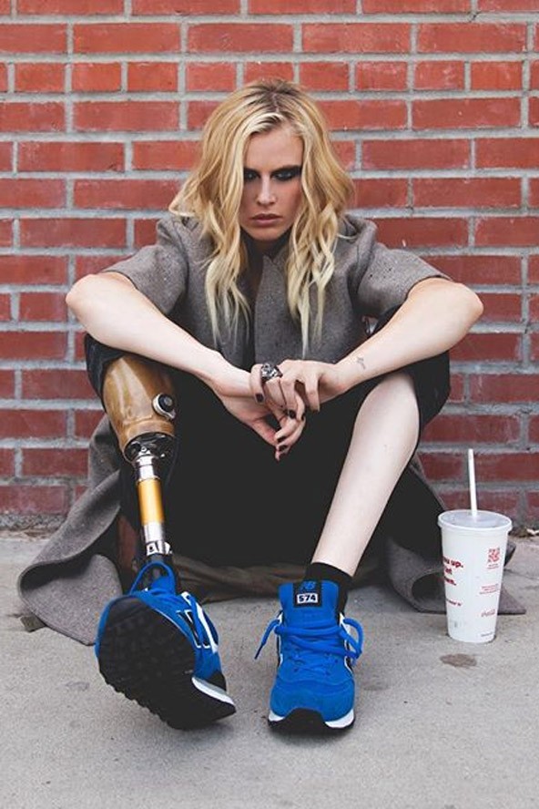 lauren wasser, műláb, műlábú modell, toxikus sokk, tss