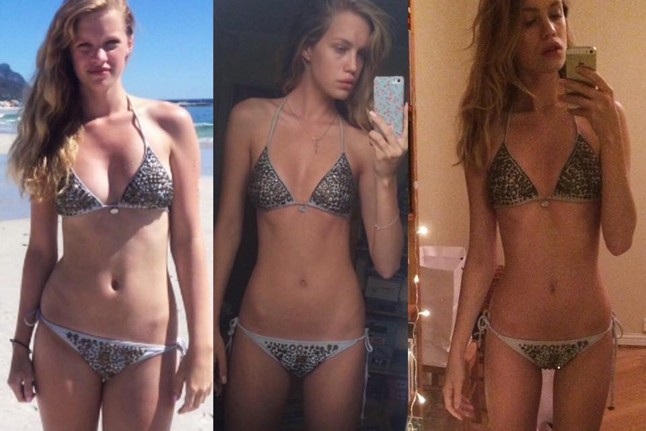 Kirúgták a modellt, mert túl kövérnek találták