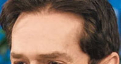 Mi történik, ha egy pasi plasztikáztat?