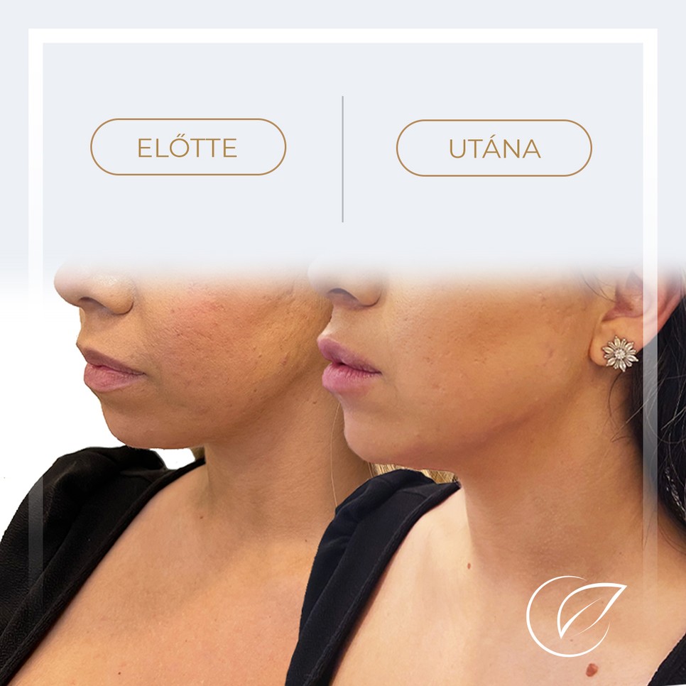 Ragyogj úgy, akár a hollywoodi sztárok!