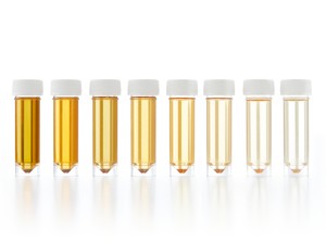 Mit árul el a vizeleted színe?