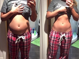 Nem terhes, csak nagy a hasa!