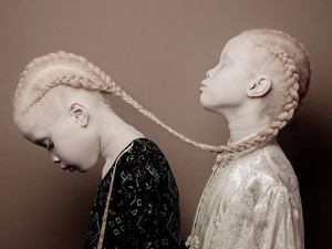 Ez a 11 éves albinó ikerpár meghódította az egész divatszakmát!