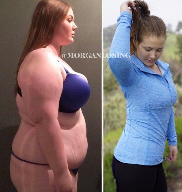 Törölték ennek a lánynak a fotóját - Miért nem tetszik az Instagramnak a fogyás?