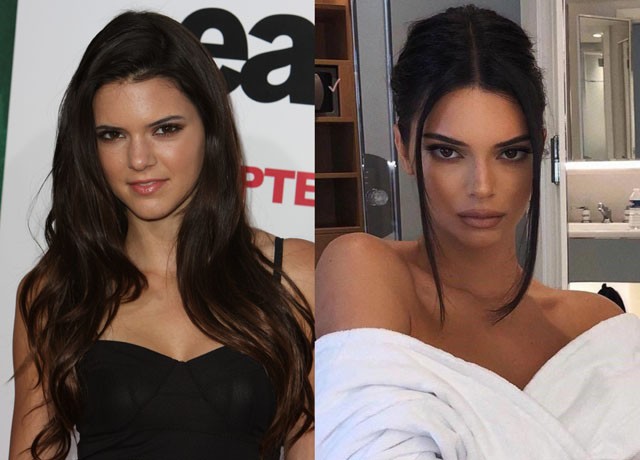 Kendall Jenner 2010-ben és most