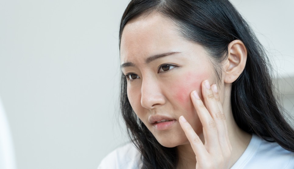 Az alkohol okozta bőrpír rövid időn belül elmúlik, de az ennél súlyosabb tünetek hosszútávon is fennállhatnak 
