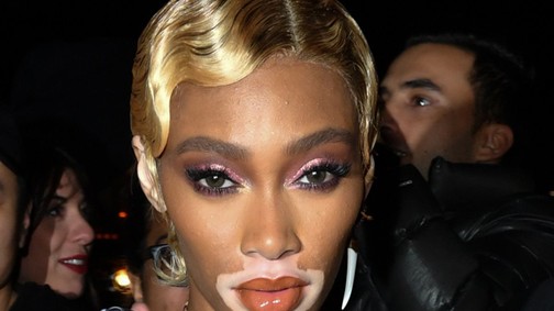 Winnie Harlow totál pucér volt a Met gála afterpartiján