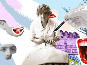 A nő, aki szép arccal és zsírleszívással támogatta társait - Ő Suzanne Noël, a világ első női plasztikai sebésze