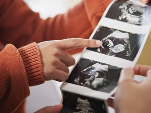 Egy lombikprogramos édesanya őszinte vallomása:„Elkeserítő volt, hogy csak egy átlagos protokollt próbáltak ránk erőltetni"