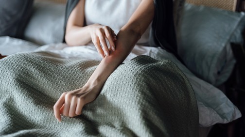 Vigyázz: ha ezt teszed, jobban vonzod a szúnyogokat