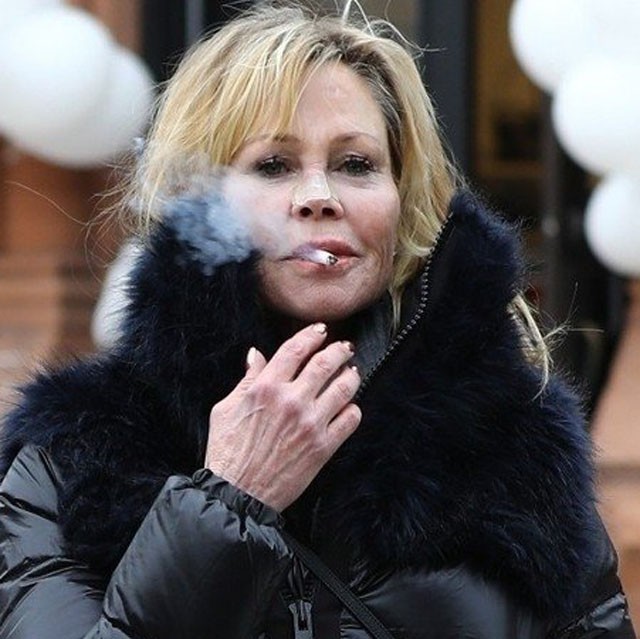 Jaj: a 90-es évek szexszimbóluma túltolta a plasztikát, már felismerhetetlen