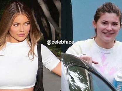 Ez az oldal bebizonyítja, hogy a tökéletesnek tűnő hírességeknek is van narancsbőrük, tokájuk és pocakjuk