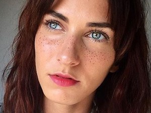 Új őrület! Szexi szeplőket szeretnél? Eljött a te időd!