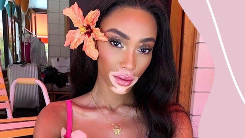  Ezt a fajta virágot válaszd a horoszkóp szerint