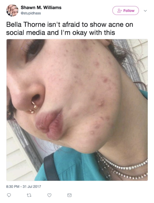 Bella Thorne nem takargatja a pattanásait, bátran vállalja szépséghibáit!