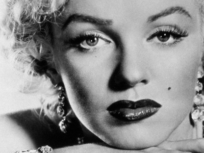 Marilyn Monroe is ebben szenvedett, a legtöbben mégsem ismerik ezt a betegséget