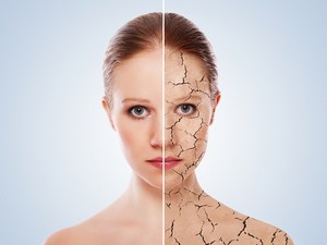 Száraz a bőröd? Meglepően sok oka lehet, íme mit kell tenned
