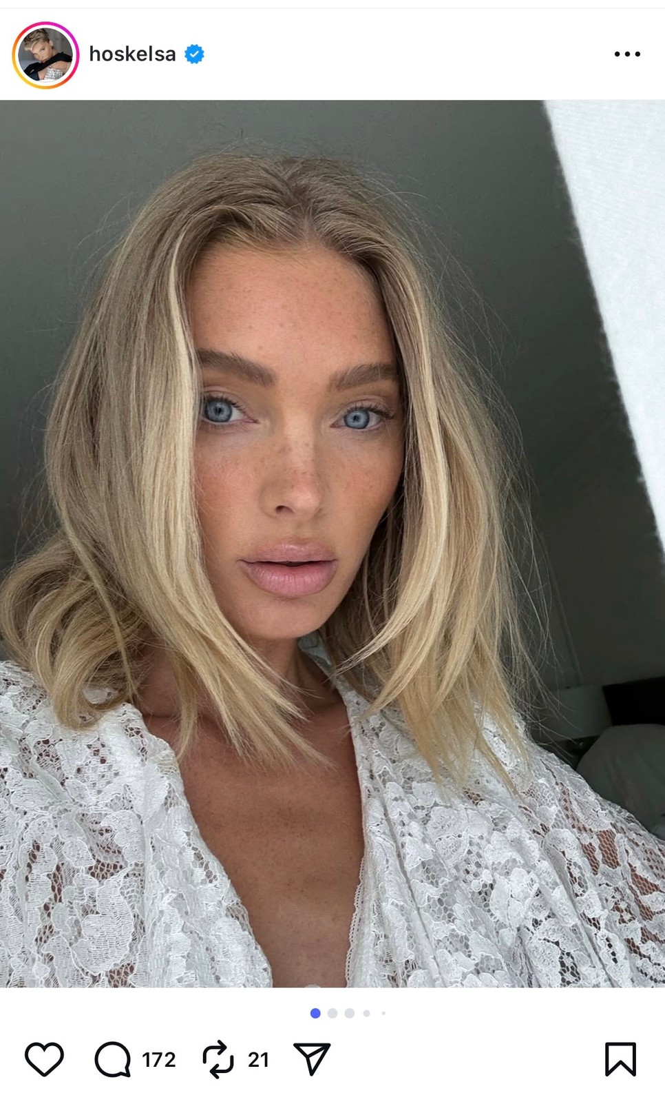 Hosk Elsa, a Victoria's Secret híres modellje is megőrül ezért a hajtrendért