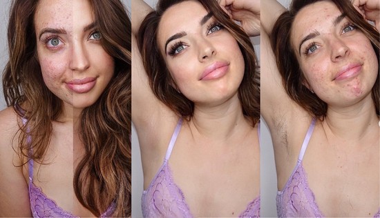 Az influenszer, aki a filterek korában is felvállalja a szőrzetét és a pattanásait - és nem kér érte elnézést