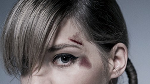 Nekem is fáj! Odettnek is, Szegedi Katának is, Farkas Franciskának is - nekünk is!