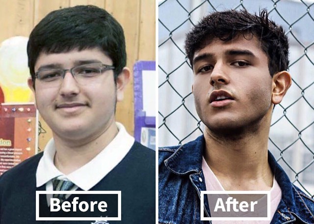 Így változik az ember arca a fogyástól! *Megdöbbentő előtte-utána fotók!*