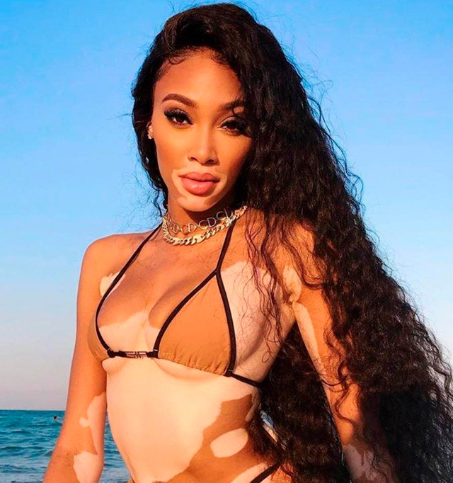 5 beauty-termék, amely nélkül nem érdemes elindulni nyaralni