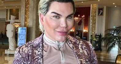 Beteges: ilyen borzalmasan néz ki 69 plasztikai műtét után az élő Ken baba arca