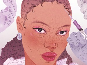 Hatékony és korszerű megoldás hajhullás ellen - ismerd meg a fejbőr injekciózás hatásait