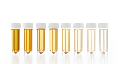 Mit árul el a vizeleted színe?